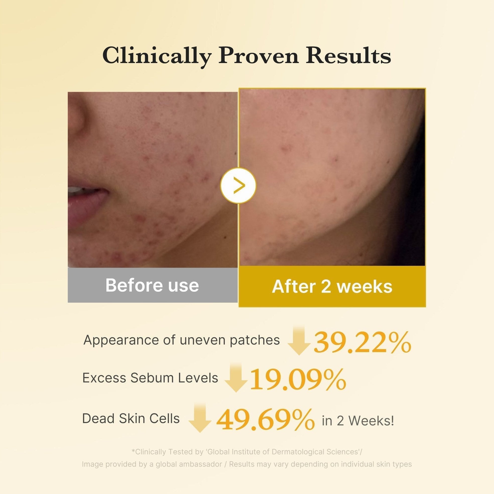 Kojic Acid Tumeric Toner Pad - Medicube