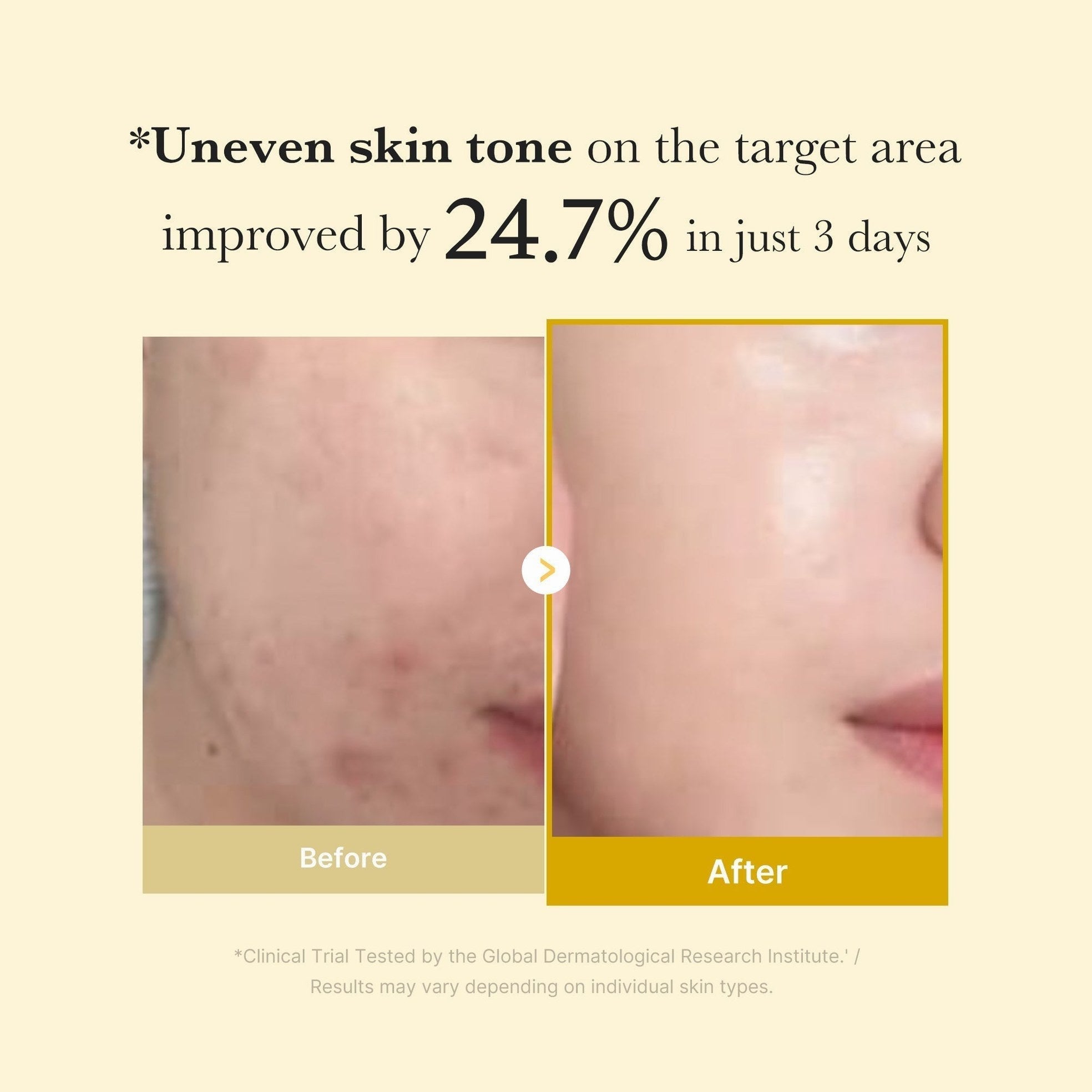 Kojic Acid Turmeric Overnight Wrapping Mask - Medicube