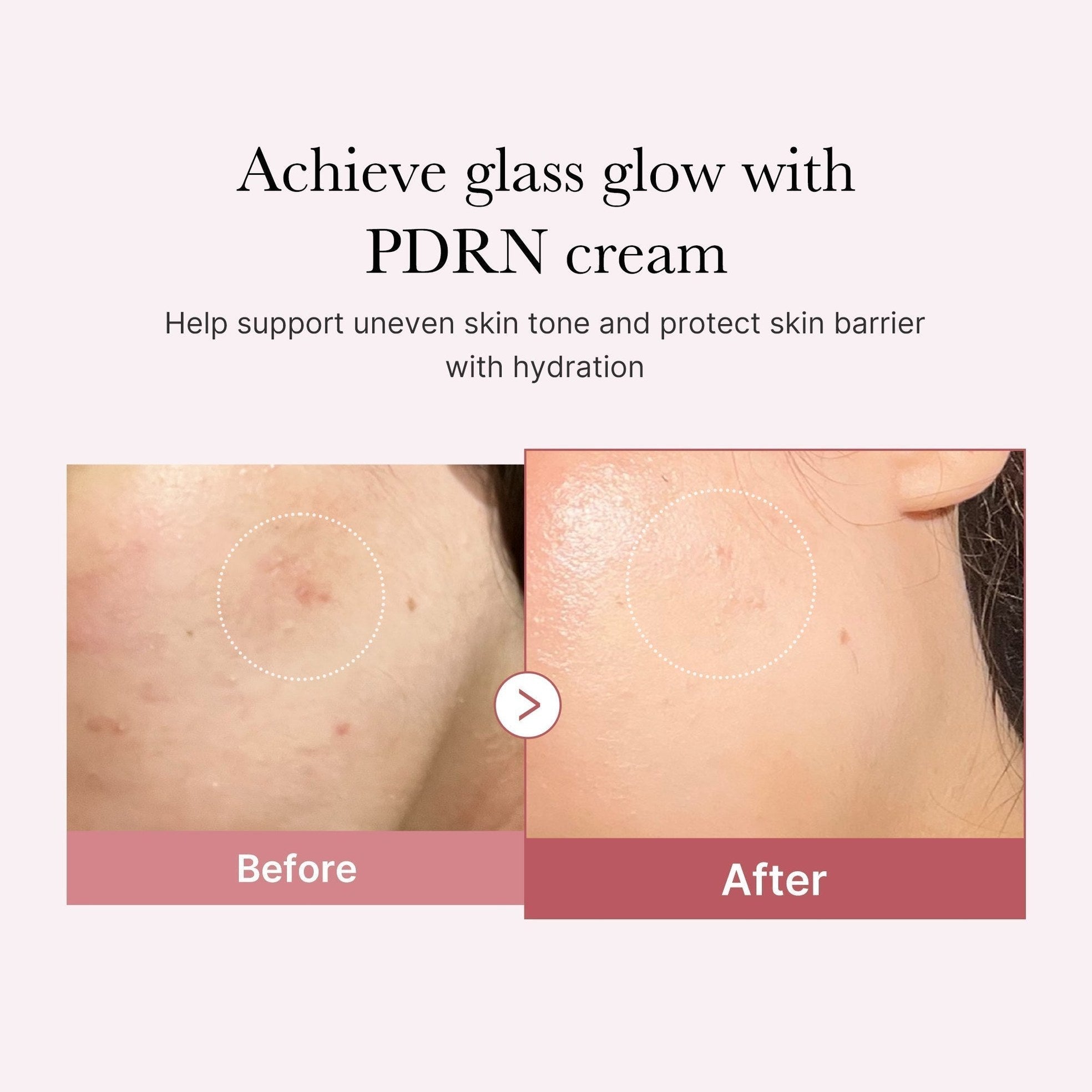 PDRN Pink Peptide Cream - Medicube