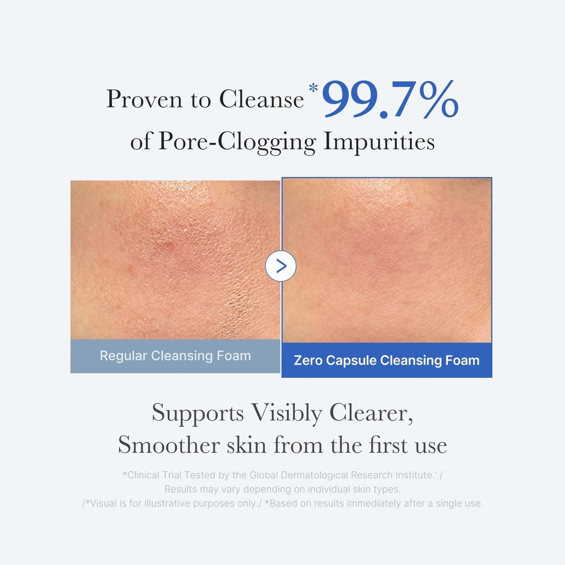 Zero Pore Capsule Cleansing Foam - Medicube
