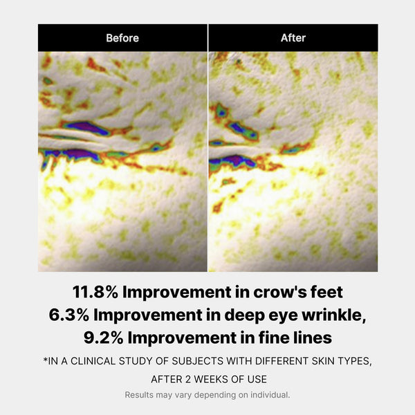 Puffiness Reduction