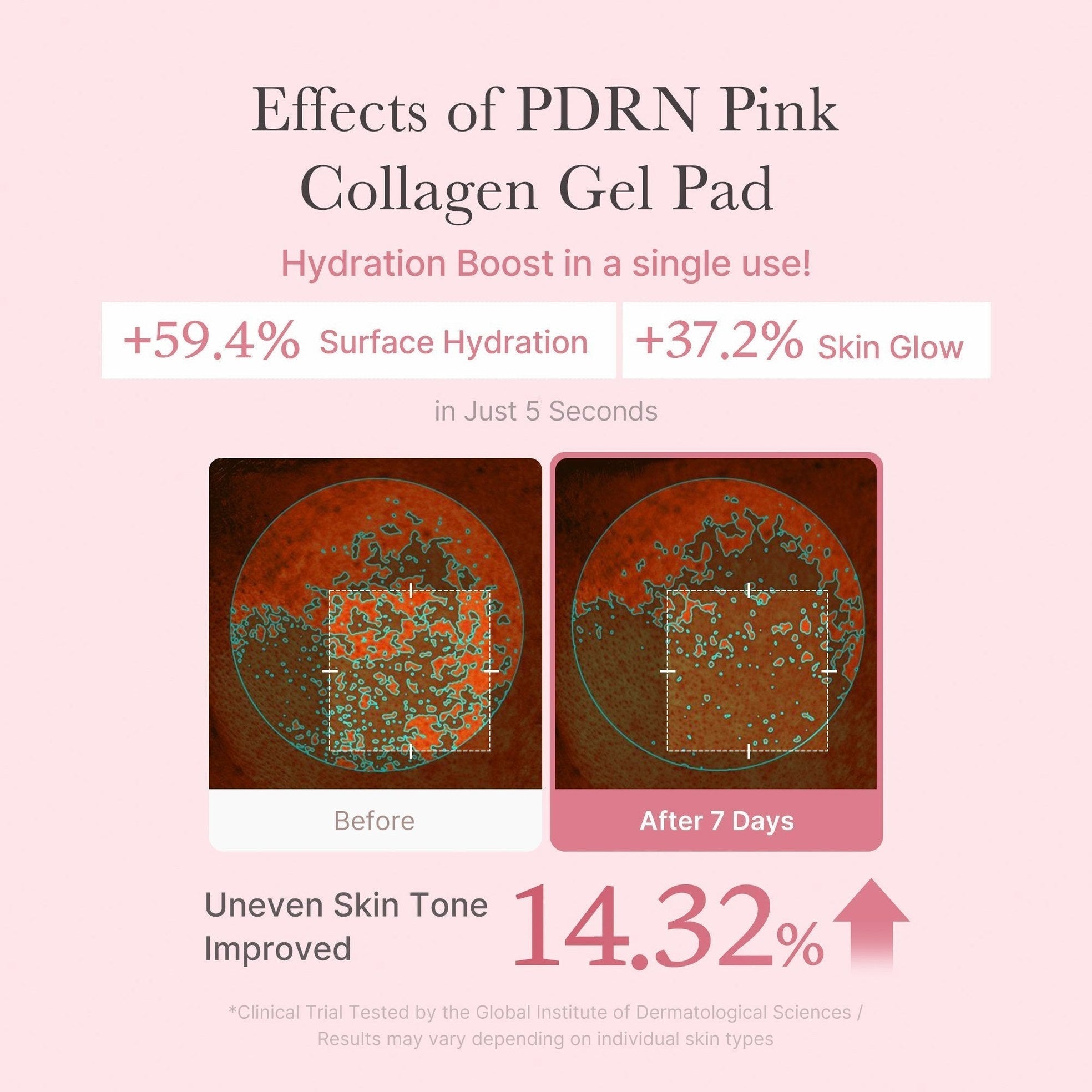 PDRN Pink Collagen Gel Toner Pad - Medicube