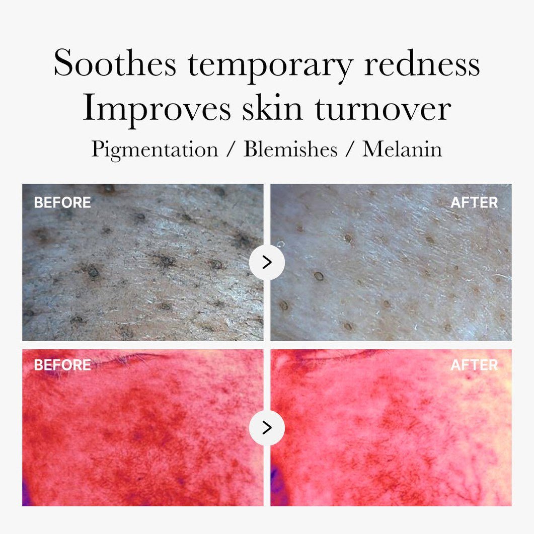 Red Succinic Acid Panthenol Pads - Medicube