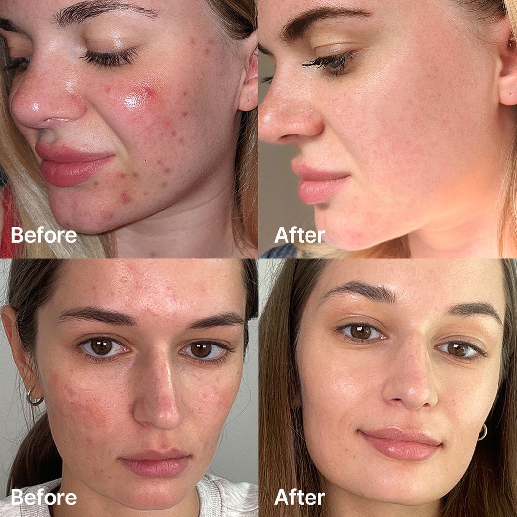 Red Succinic Acid Serum - Medicube
