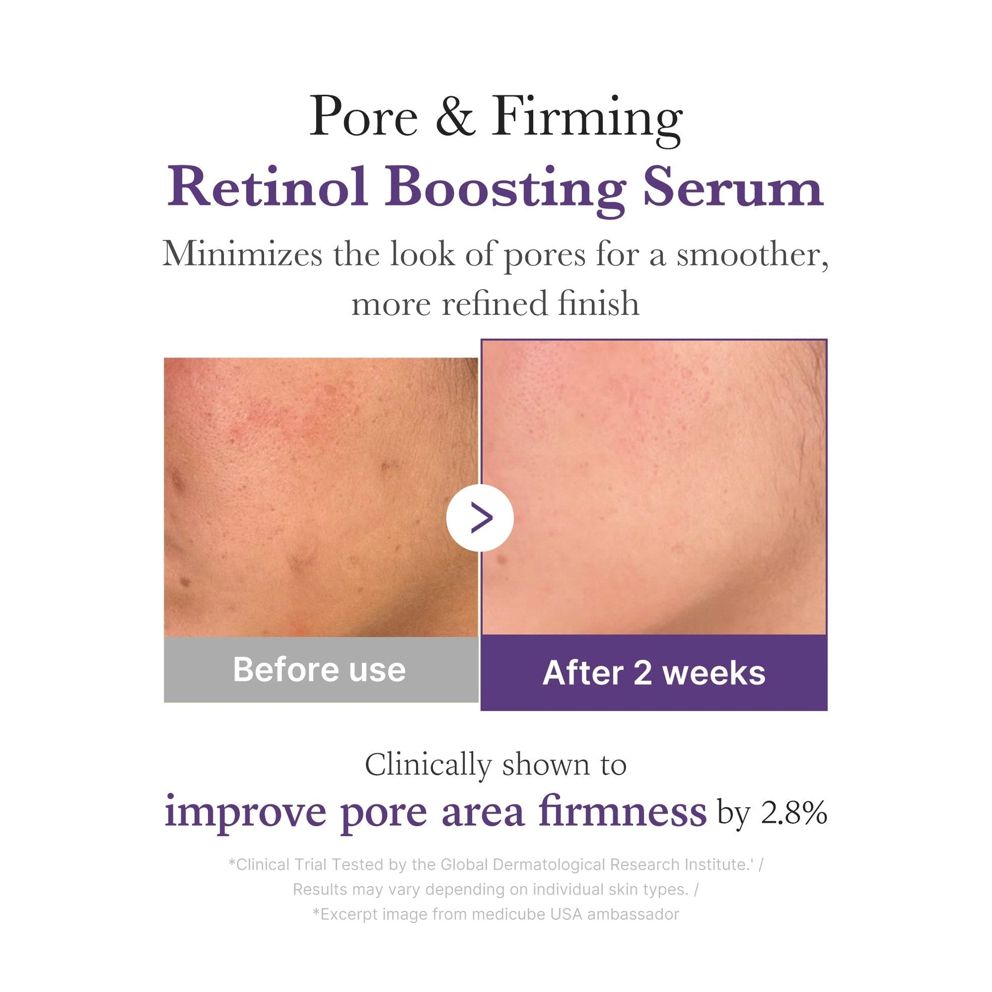 Retinol NMN Boosting Serum - Medicube