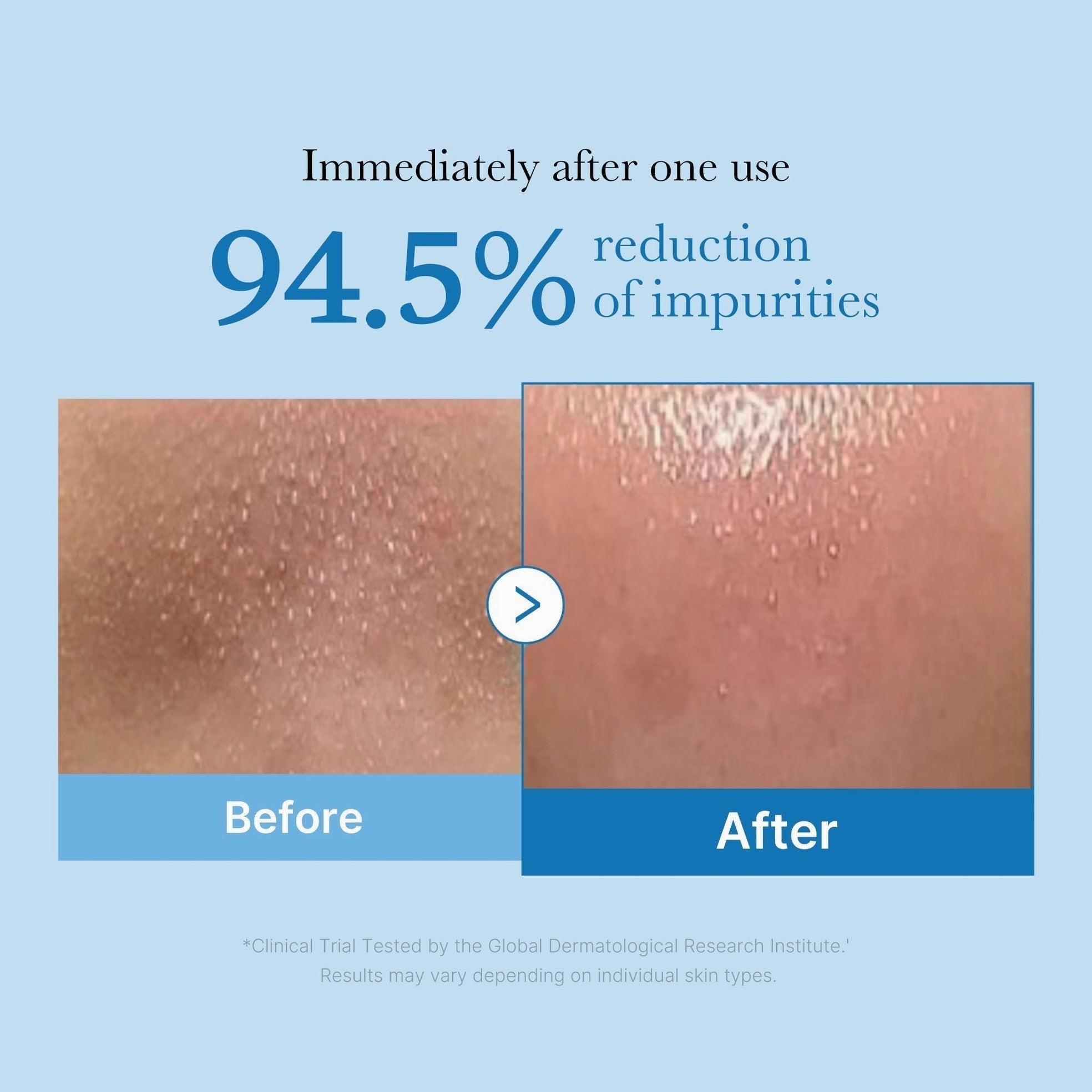 Zero Pore Blackhead Deep Cleansing Oil - Medicube
