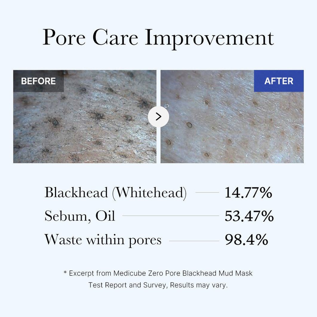 Zero Pore Blackhead Mud Mask - Medicube