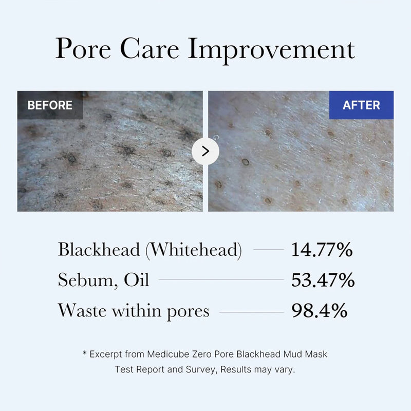 Deep Pore Cleansing for Visibly Blackhead-Free Skin