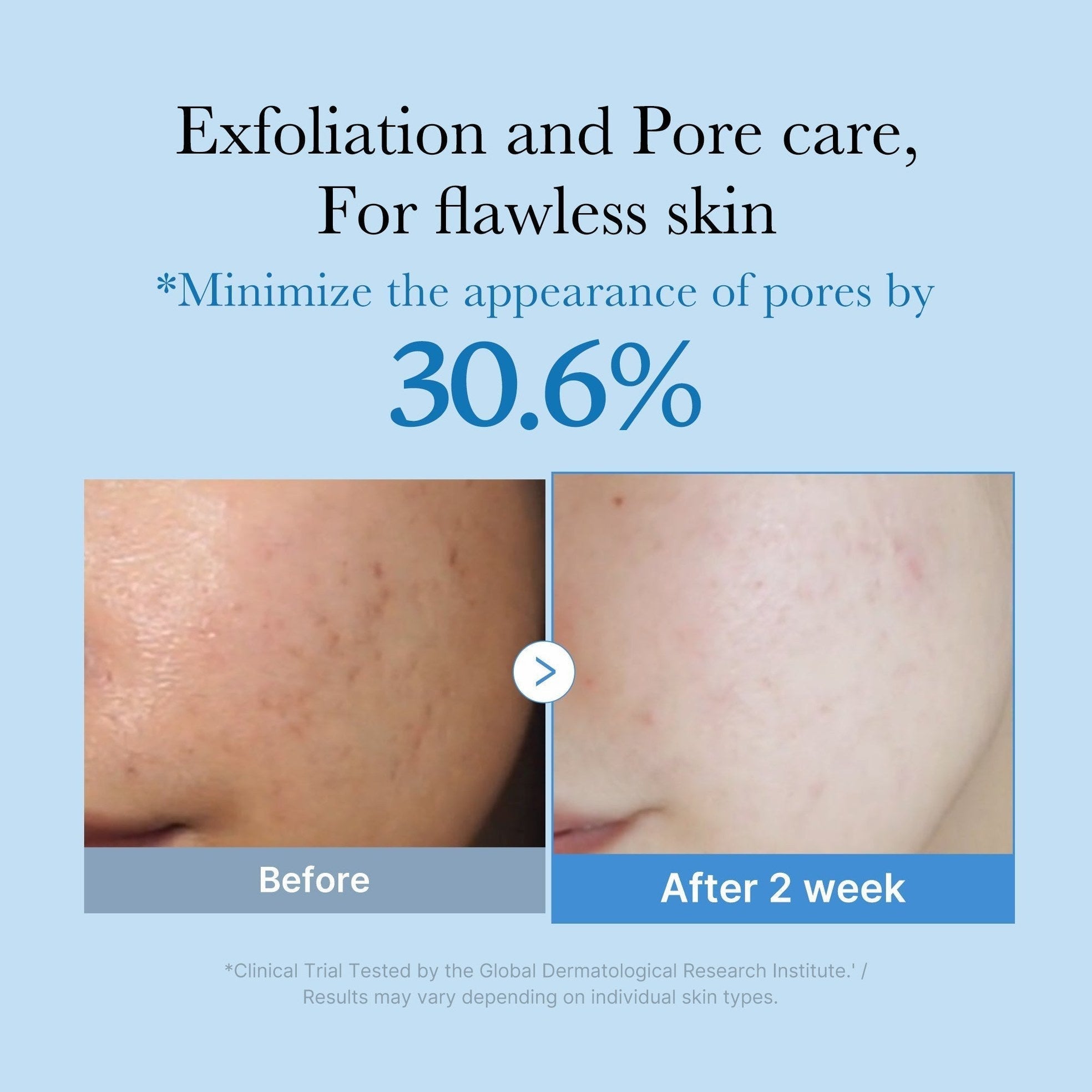 Zero Pore Toner - Medicube